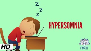 ICD 10 diagnostic criteria for Hypersomnia Excessive sleep disorder [upl. by Ahsiekar]