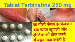 Tablet Terbinafine 250 Mg Full Review In Hindi  Uses  Dose  Side Effects Tarbinafine Tablet Uses [upl. by Varick]