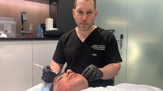 How to Get Rid of Acne Scars  Dermal FillerSubcision  Acne Scar Combination Tx  Part 1  Dr Emer [upl. by Dalenna990]