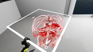 Virtual Reality in Medicine New Opportunities for Diagnostics and Surgical Planning [upl. by Livvyy]