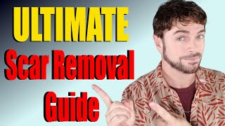 Scar Removal Products That Work  ULTIMATE Product Guide  Chris Gibson [upl. by Dagney348]