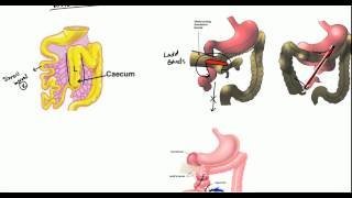 Peritoneal Recesses Dr Adel Bondok Making Anatomy Easy [upl. by Ennyletak]