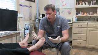 Treating Toenail Fungus with Lamisil [upl. by Warton298]