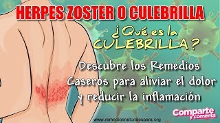 🔥 HERPES EN LA PIEL 🔥 Como curar la CULEBRILLA  HERPES ZOSTER  Rápido con Remedios Caseros💚 [upl. by Westland]