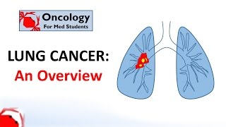 Lung Cancer An Overview [upl. by Michi695]