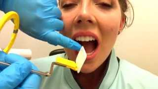 How to Take Periapical Radiographs [upl. by Esmerelda]