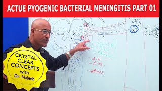 Acute Pyogenic Bacterial Meningitis Part 1 🩺 [upl. by Taka]