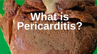 Diagnosis of myocarditis and pericarditis part 1  NCLEXRN  Khan Academy [upl. by Yecnahc]