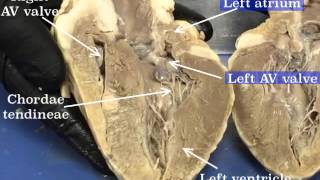 Sheep Heart Dissection  Part 2 [upl. by Akzseinga]