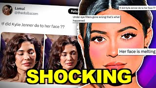 WHAT HAPPENED TO KYLIE JENNER [upl. by Ferdinana]