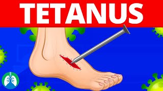 Tetanus Medical Definition  Quick Explainer Video [upl. by Horner]