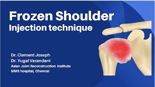 frozen shoulder injection technique [upl. by Florrie563]