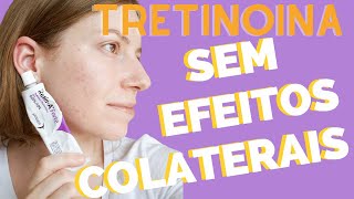 COMO COMEÇAR A USAR A TRETINOINA  Vitanol A Vitacid RetinA [upl. by Sivie]