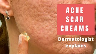 Acne Scar Creams  Dermatologist Reviews [upl. by Naniac]