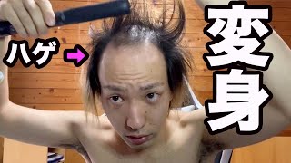 【ハゲのヘアセット術】薄毛男子の本気 髪型セットルーティン【超変化】 [upl. by Magdau]