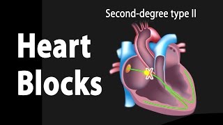 Arrhythmia Symptoms and Causes [upl. by Fablan]