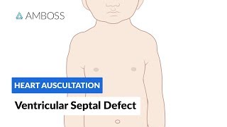 Ventricular Septal Defect VSD  Heart Auscultation  Episode 11 [upl. by Jacobina717]