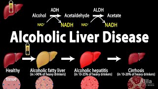 Alcoholic Liver Disease Animation [upl. by Robinette663]