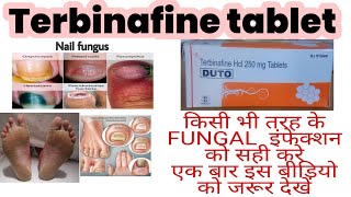 Terbinafoce Tablet use Hindi  Terbinafine Tablet IP 250mg  antifungals tablet  Tarbinafoce tablet [upl. by Anairt]