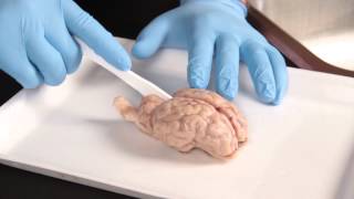 Carolina Quick Tip® Sheep Brain Dissection [upl. by Swihart]