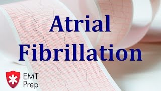 Atrial Fibrillation ECG  EMTprepcom [upl. by Brier590]