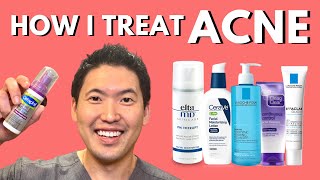 How I Treat Acne An Overview of Treatment Options [upl. by Hayimas]