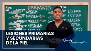 ANGIOEDEMA Y URTICARIA CAUSAS SÍNTOMAS Y TRATAMIENTO [upl. by Mctyre785]