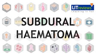 Subdural Haematoma [upl. by Kurland]