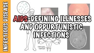 Opportunistic Infections and AIDSdefining illnesses  CD4 cell count malignancy treatment [upl. by Godric797]